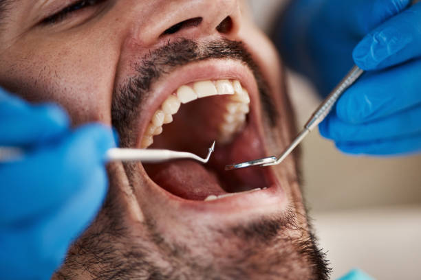 Best Dentist for Tooth Abscess  in Stone Mountain, GA